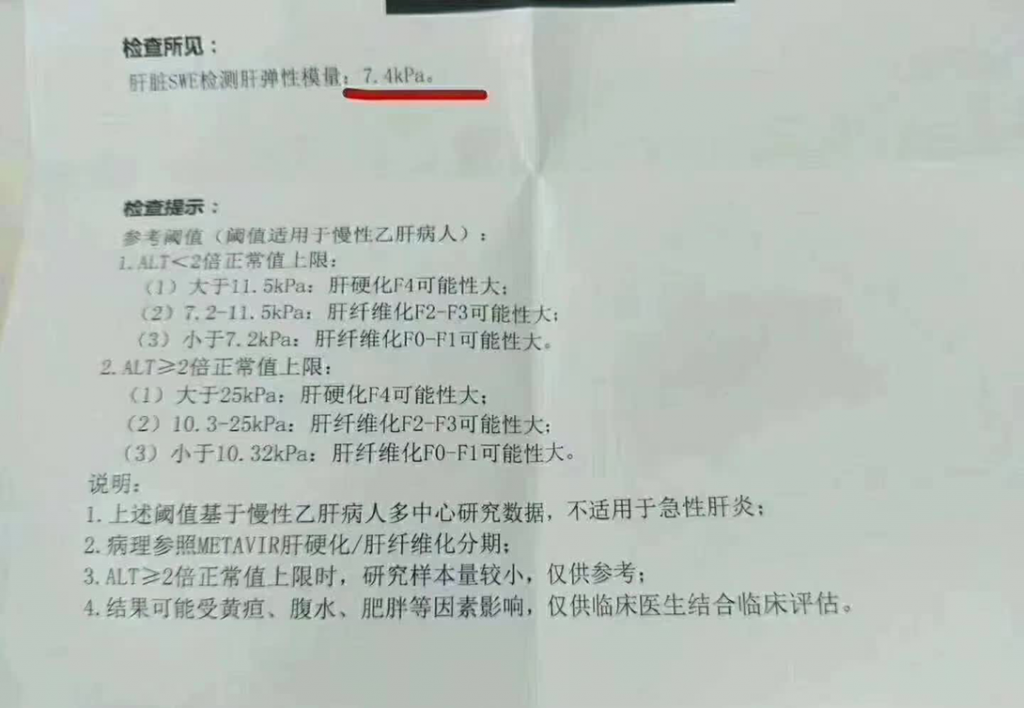 服用龙牙肝泰后,肝硬度7.4