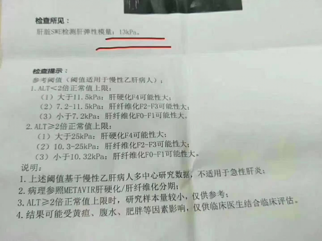 服用龙牙肝泰前,肝硬度13