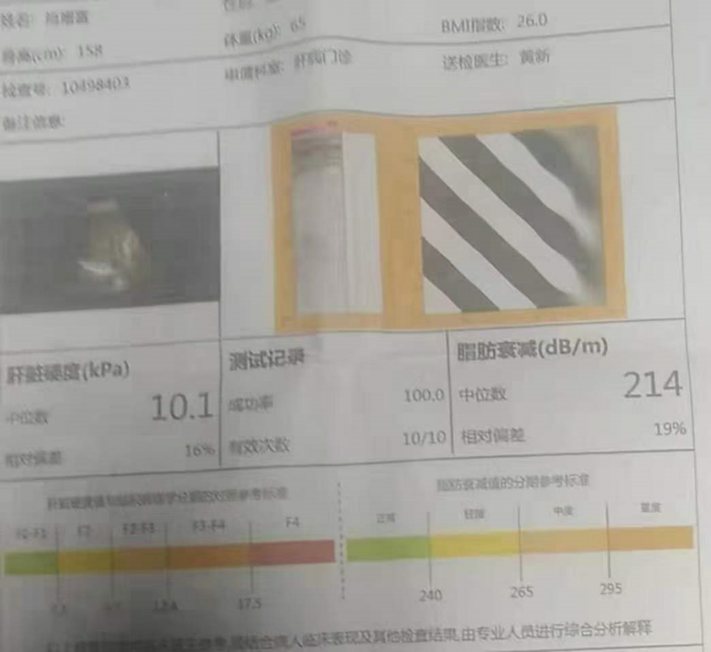 服用龙牙肝泰后,肝硬度10.1